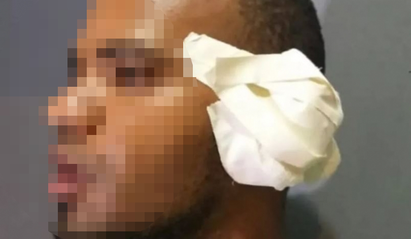 orelha arrancada em briga no Maranhão homem suspeito