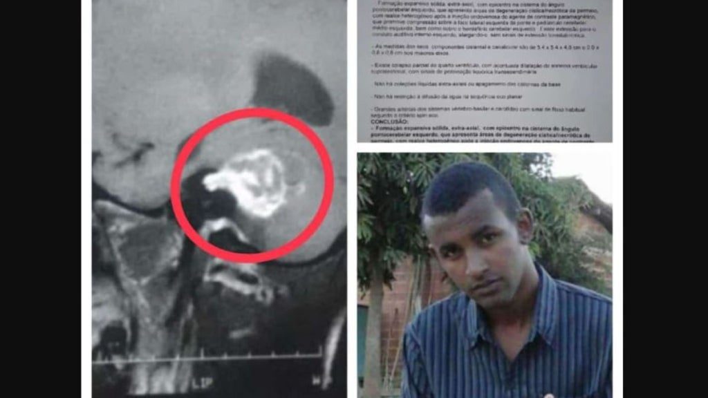 regenerense com doença rara Fábio Vasconcelos Santos