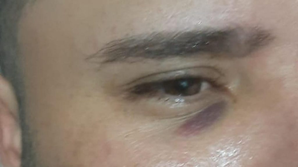 Após confusão durante festa em Amarante, empresário faz B.O. contra atleta Juninho
