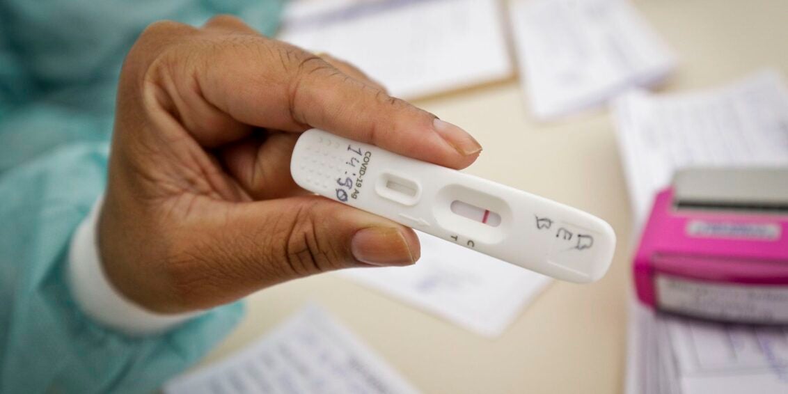 Positividade de testes de covid-19 subiu de 4% para 13%, diz UFRJ