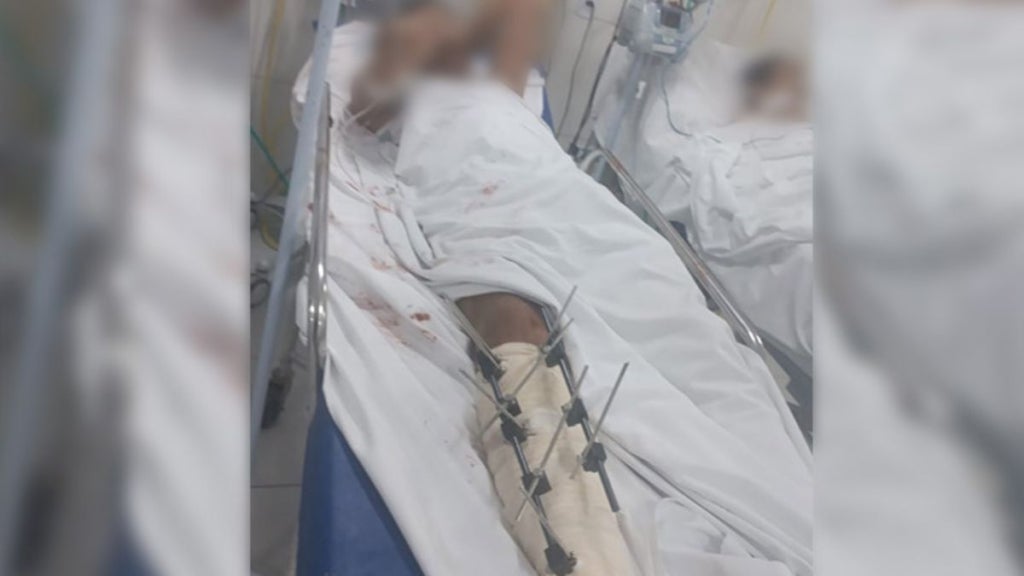 Adolescente tenta matar jovem em Teresina após visitá-lo na UPA depois do crime