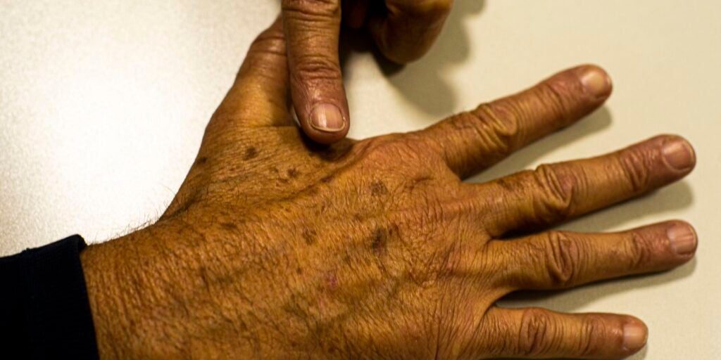 Inca manifesta apoio a imposto seletivo sobre bebidas alcoólicas