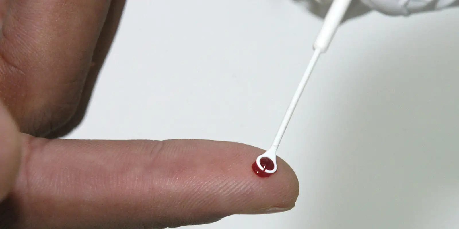 Saúde amplia vacinação contra o HPV para quem usa PrEP