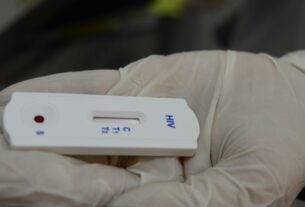 Saúde orienta farmácias sobre testes para HIV, sífilis e hepatites