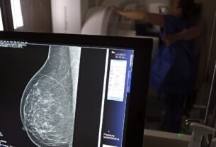 Cerca de 77 mil mulheres aguardam mamografia pelo SUS