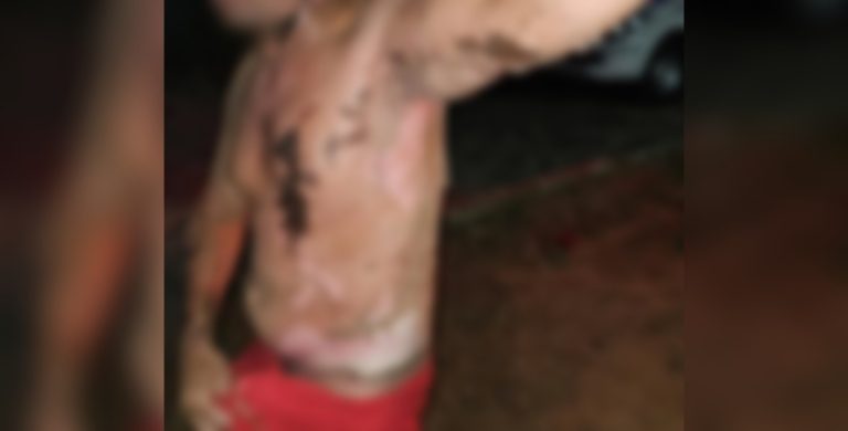 Mulher é presa em Elesbão Veloso após atear fogo no marido com cachaça