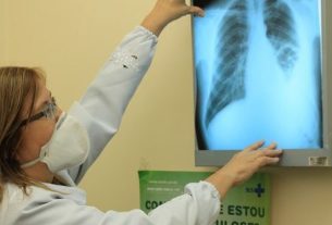 Brasil está na contramão da meta da OMS para extinção da tuberculose