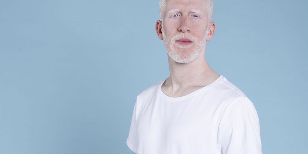 Sancionada lei que cria política de proteção a pessoas com albinismo