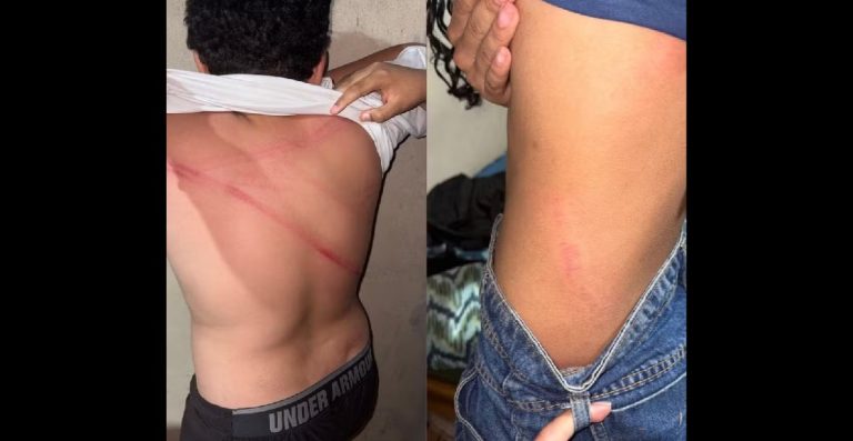 Homem é preso por provocar lesões nos filhos adolescentes em Simplício Mendes