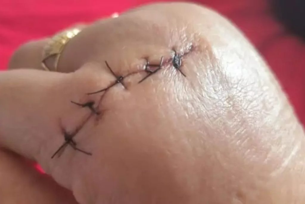 Professora é esfaqueada por aluna de 14 anos em escola de Caseiros