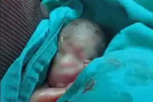 Imagem de close do recém-nascido José Pedro entubado na UTI neonatal