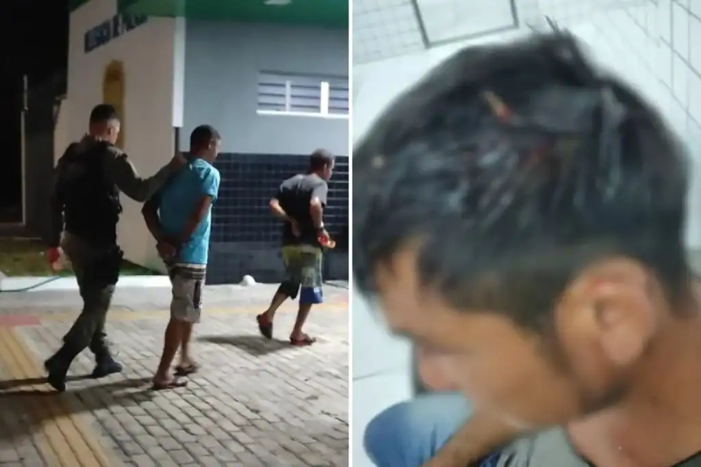 Rosto da vítima (Benedito) com ferimentos e manchas de sangue após a agressão em Parnaíba