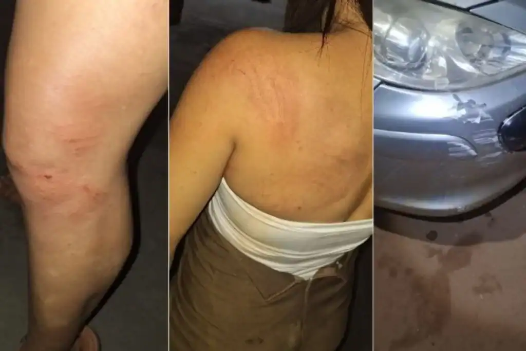 Viatura da Polícia Militar inspeciona o carro apreendido, usado no atropelamento da companheira em Sebastião Barros.