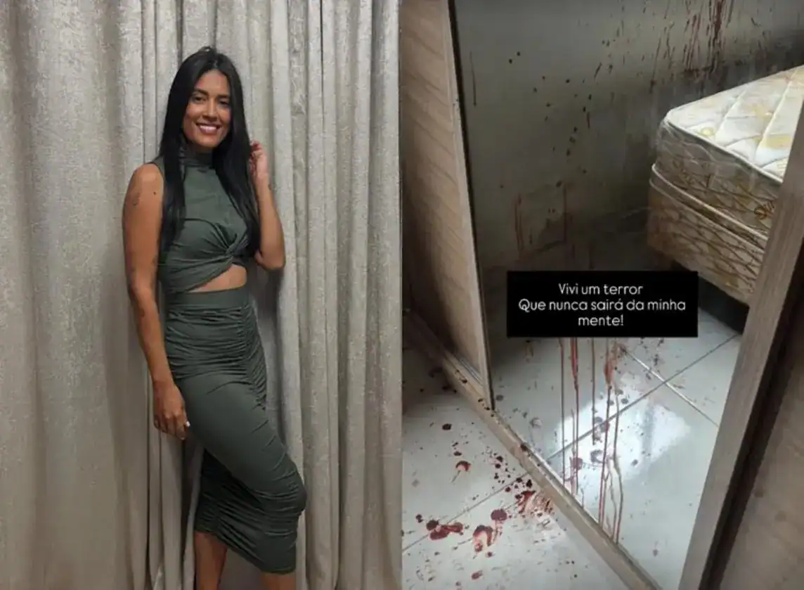 Meiry Nunes, Secretária de Saúde de Francisco Ayres, vítima de agressão e ameaças do ex-namorado Bruno Lima.