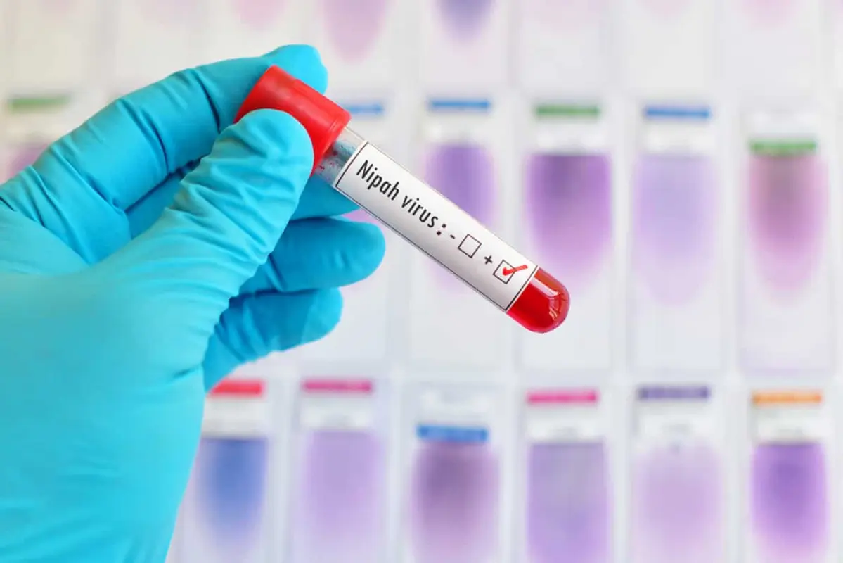 Índia registra novo surto de vírus Nipah e Tailândia reforça vigilância em aeroportos 1 Ilustração 3D do vírus Nipah, com foco em sua estrutura e ameaça à saúde pública global.