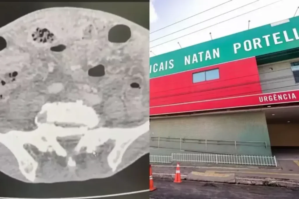 Médico radiologista examinando imagens digitais em tela de computador, representando a telerradiologia e os desafios de diagnóstico.